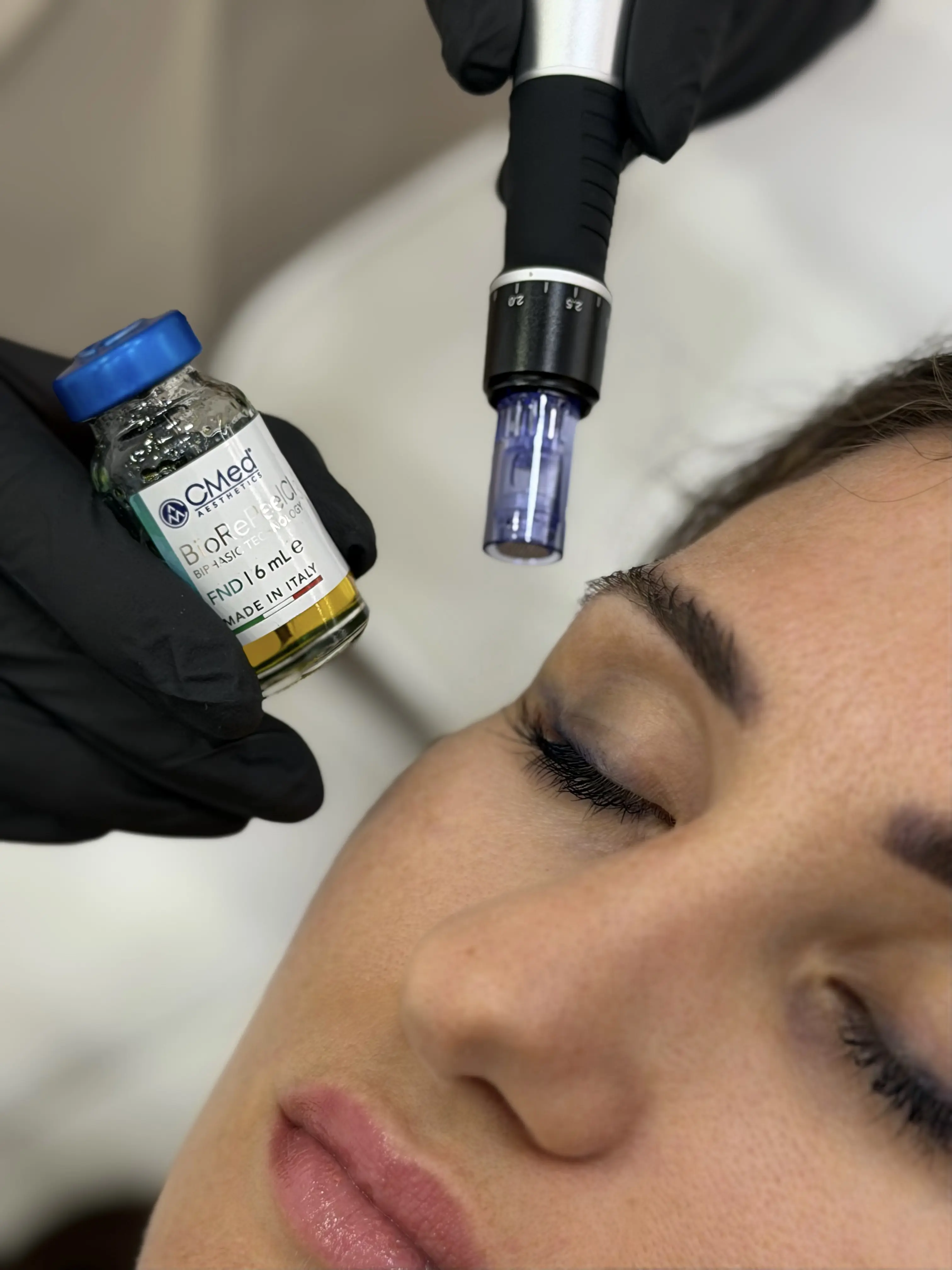Дермална биостимулация в Bella Derma