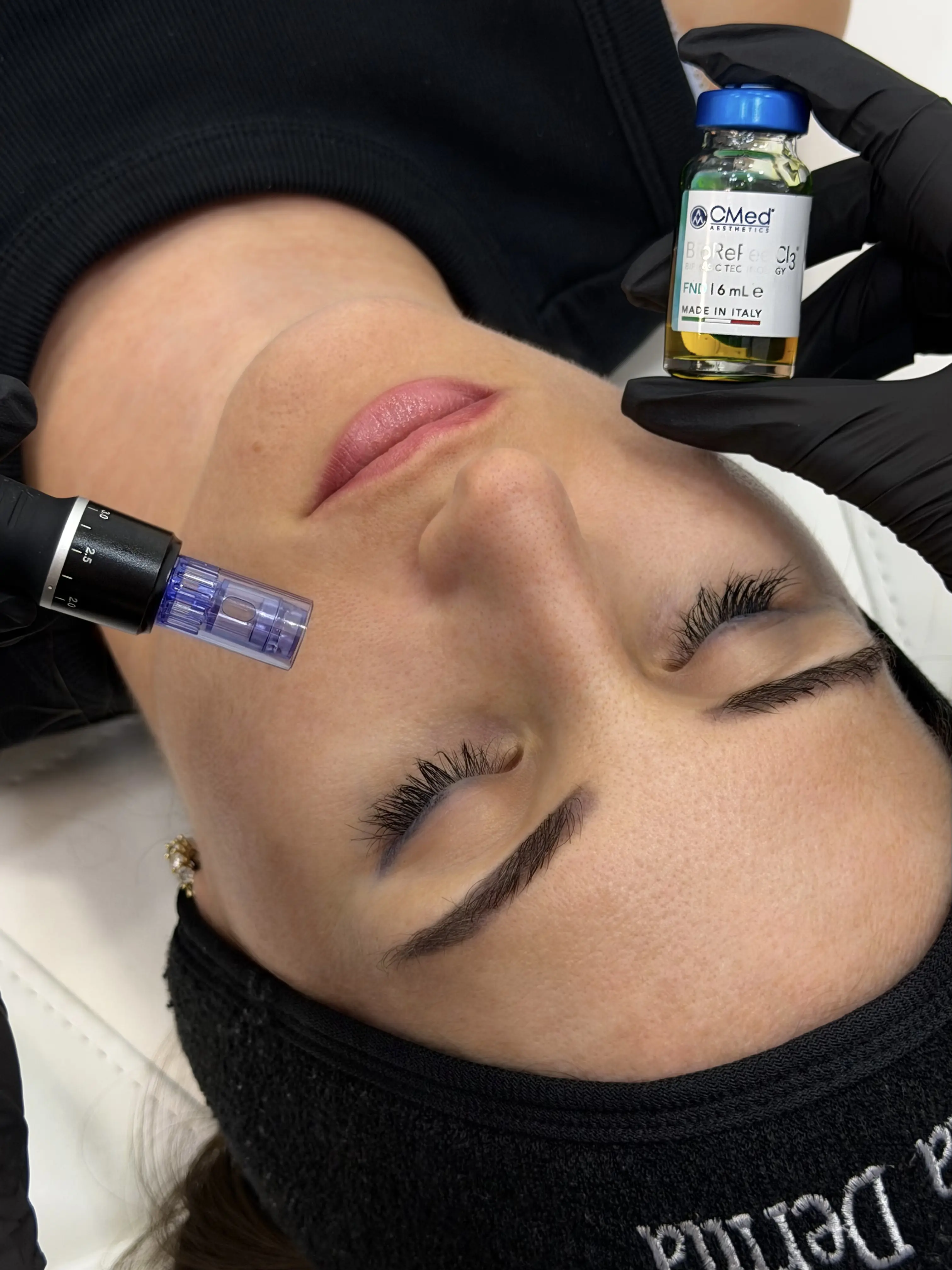 Микронидлинг Dr. Pen и пилинг BioRePeelCl3 в Bella Derma