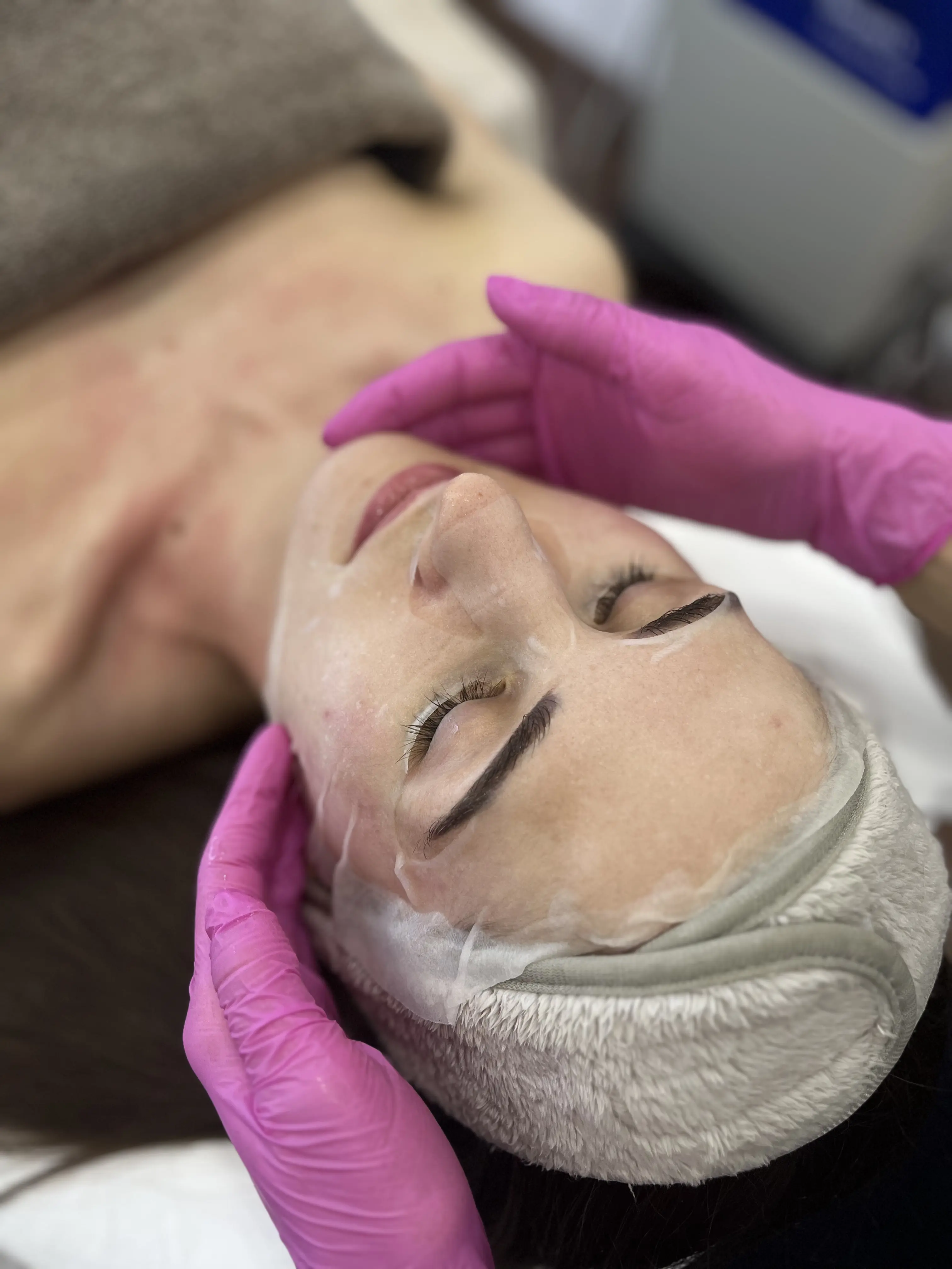 Дермална биостимулация в Bella Derma