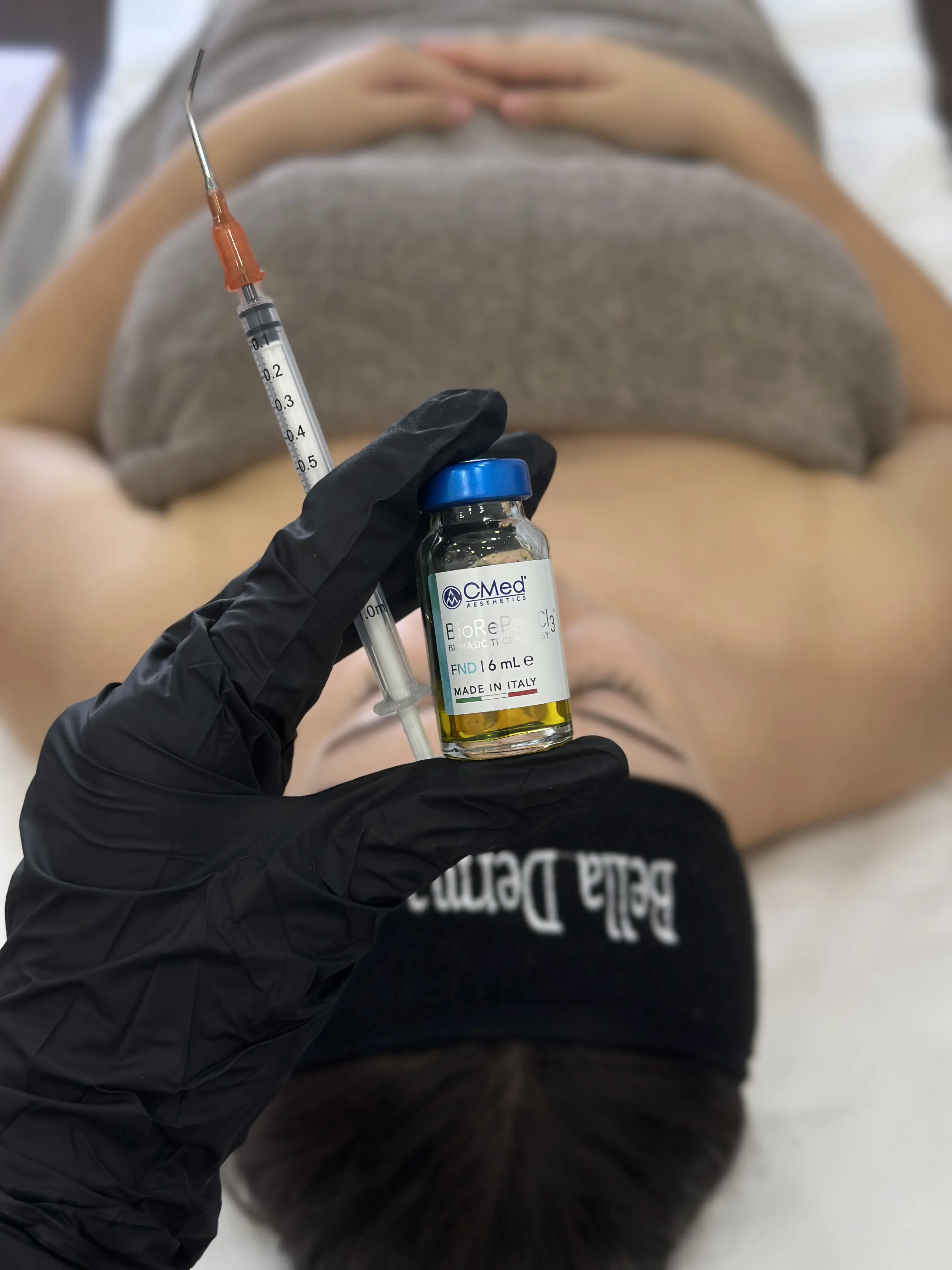 Пилинг процедури в Bella Derma